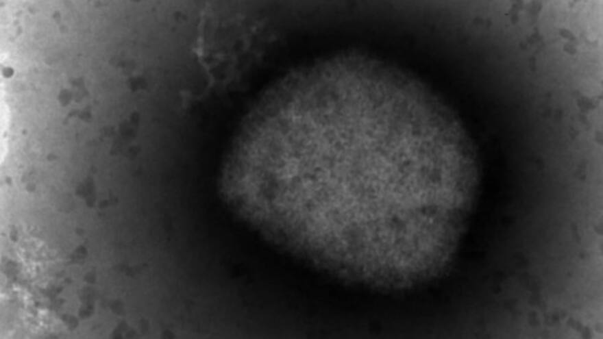 Viruela del mono: obtienen la secuencia completa del virus en España