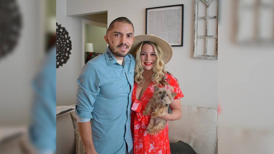 Hombre sobrevivió a ataque de caimán en Florida