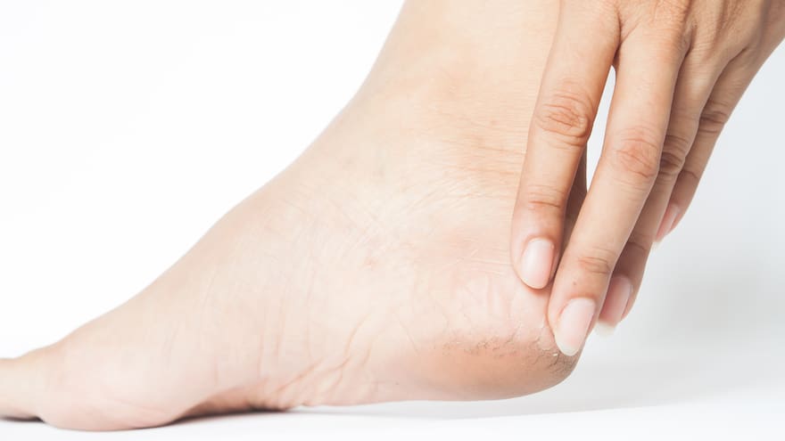 Vinagre y sal para los pies: el remedio casero que elimina mal olor y previene hongos