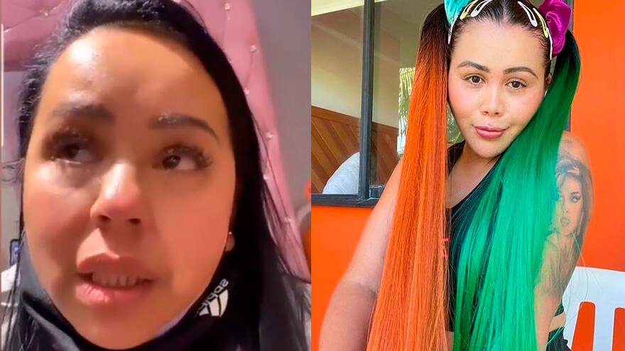 Se me enloqueció: madre de Yina Calderón al enterarse de las 10 cirugías de su hija