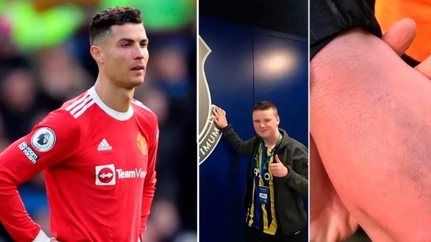 Niño que agredió Cristiano Ronaldo padece autismo y dispraxia