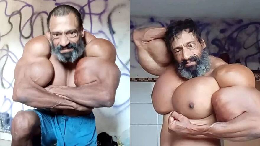Muere a los 55 años el ‘Hulk Brasileño’ que se inyectaba aceite en los músculos