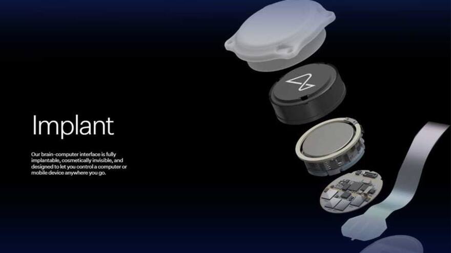 Telepathy, el primer chip cerebral implantado a un ser humano