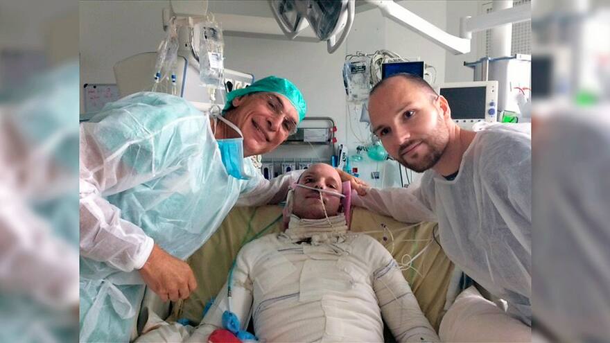 Trasplante de piel de gemelo salva a un quemado casi integral