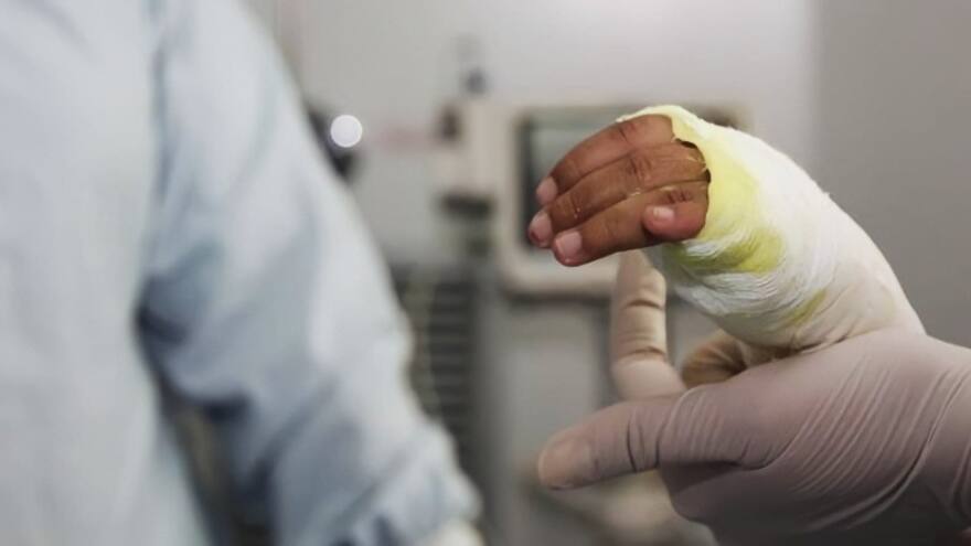 Se registra el primer fallecido del año por manipulación de pólvora