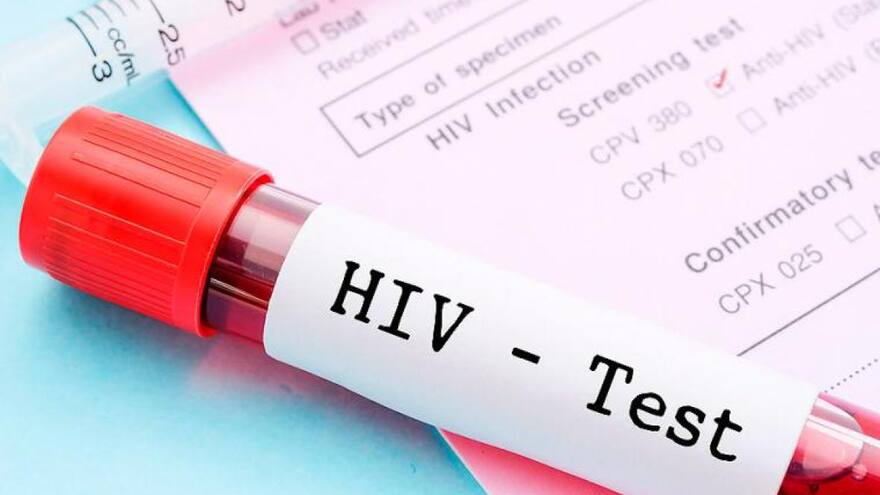 Día Mundial de la Lucha contra el VIH y el Sida: Cartagena alerta por aumento de casos en 2023