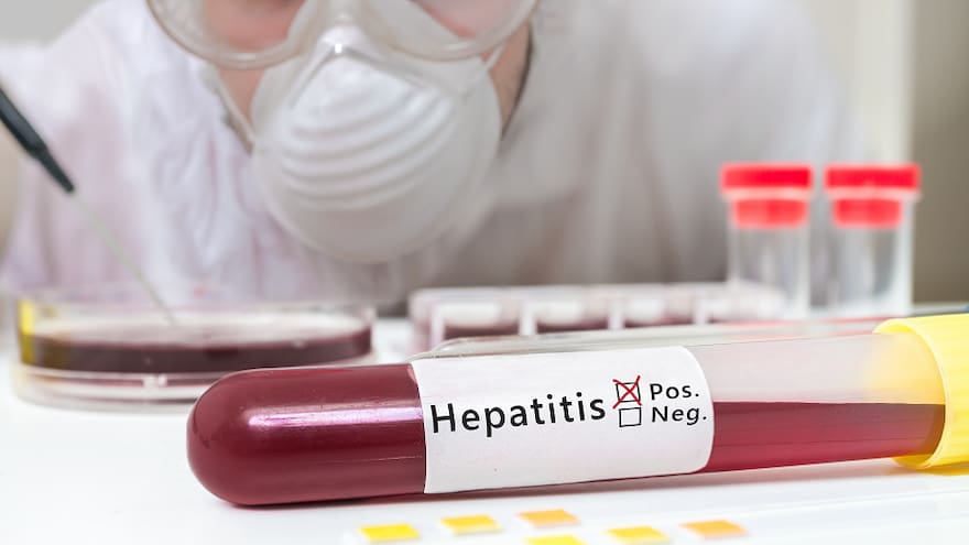 Detección oportuna, clave para superar hepatitis infantil