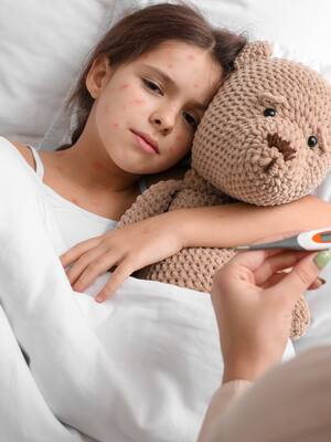 Viruela del mono | Columna de Remberto Burgos