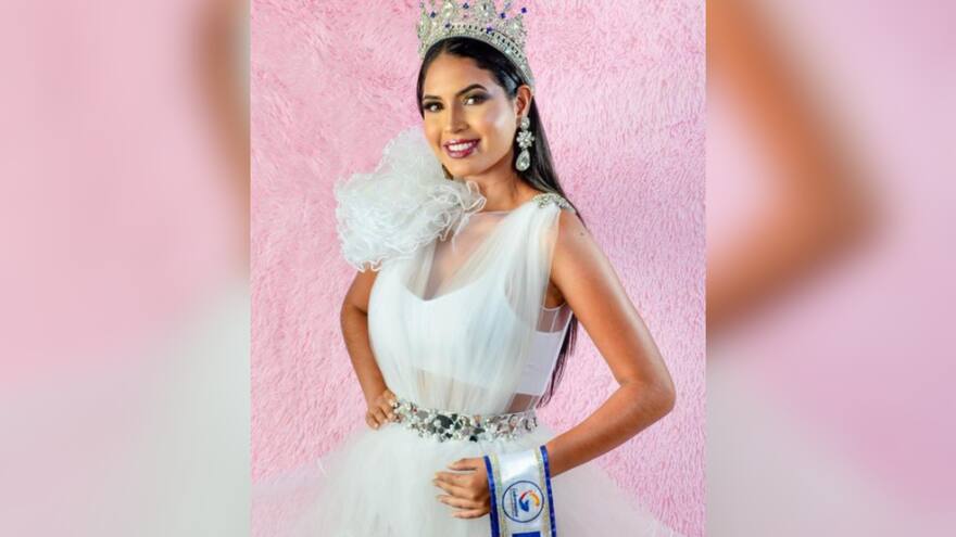 Murió a los 24 años Wilevis Brito, reina de belleza de Venezuela, tras una cirugía maxilofacial