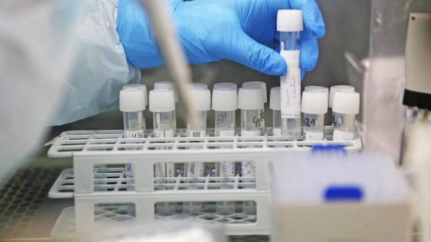 Lo que se sabe del NeoCoV, el coronavirus que alerta a los científicos