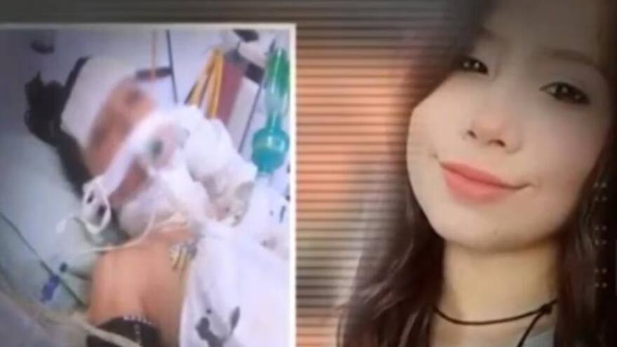 Joven de 20 años murió, luego de ir al odontólogo para la extracción de una muela. ¿Por qué pasó?