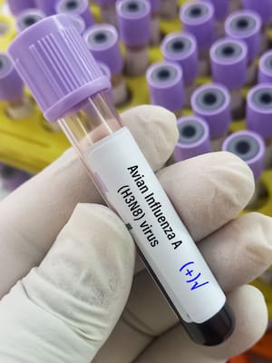¿Una nueva pandemia a la vuelta de la esquina? | Columna de Isidoro Hazbún