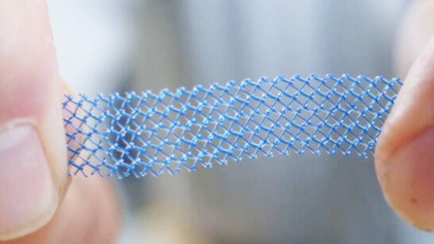 Confirman condena a Johnson & Johnson por implantes vaginales en Australia