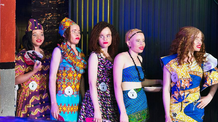 Miss Albina, el reinado que lucha contra los prejuicios en Zimbabue