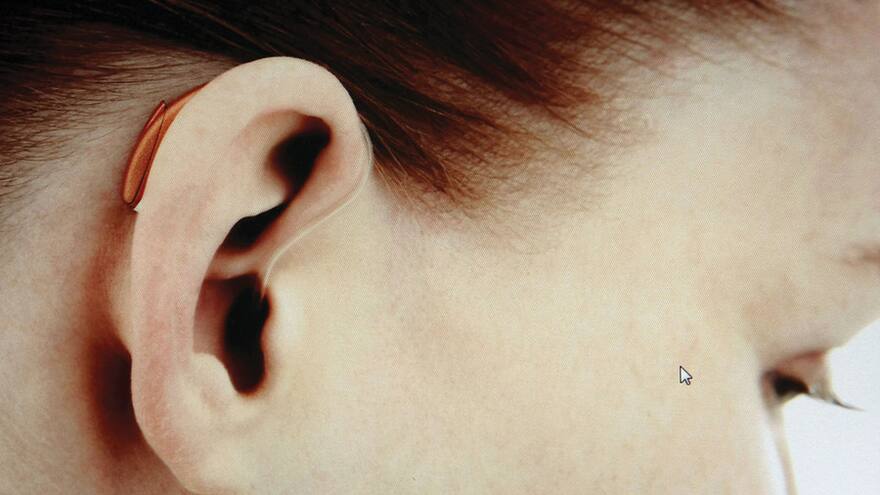 Estas son las señales de alarma sobre pérdida parcial o total de la audición