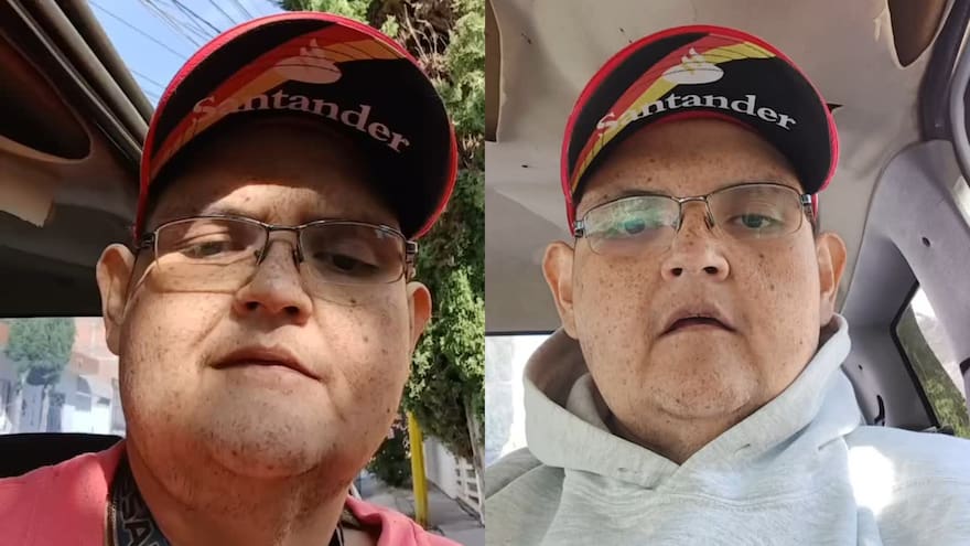 Muere el mexicano Juan Pedro Franco, conocido por haber sido el hombre más obeso del mundo