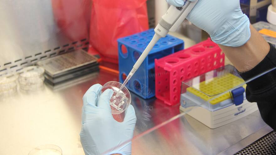 Se confirma sexto caso exitoso de remisión del VIH tras trasplante de médula ósea