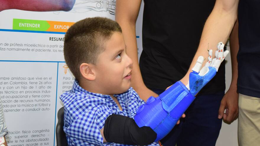 El Sena busca fabricar prótesis a bajo costo