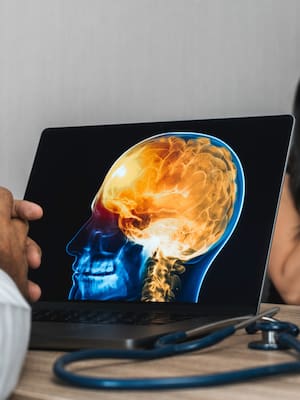 La lucha contra  las encefalitis