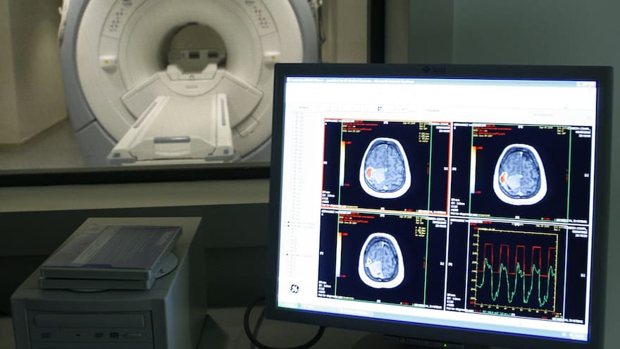 EE.UU. aprueba un medicamento prometedor contra el alzhéimer