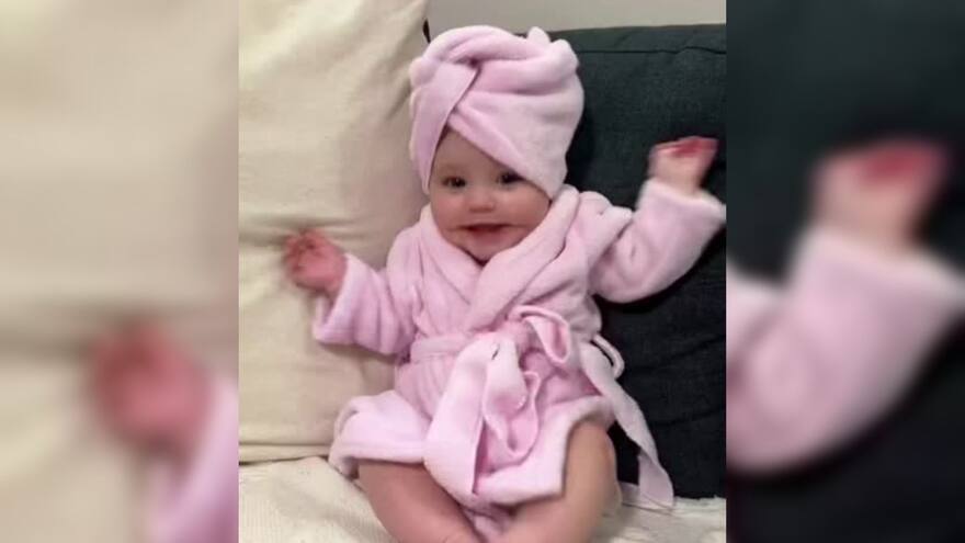 Niña que nació con síndrome de la ‘sonrisa permanente’ conquista las redes sociales