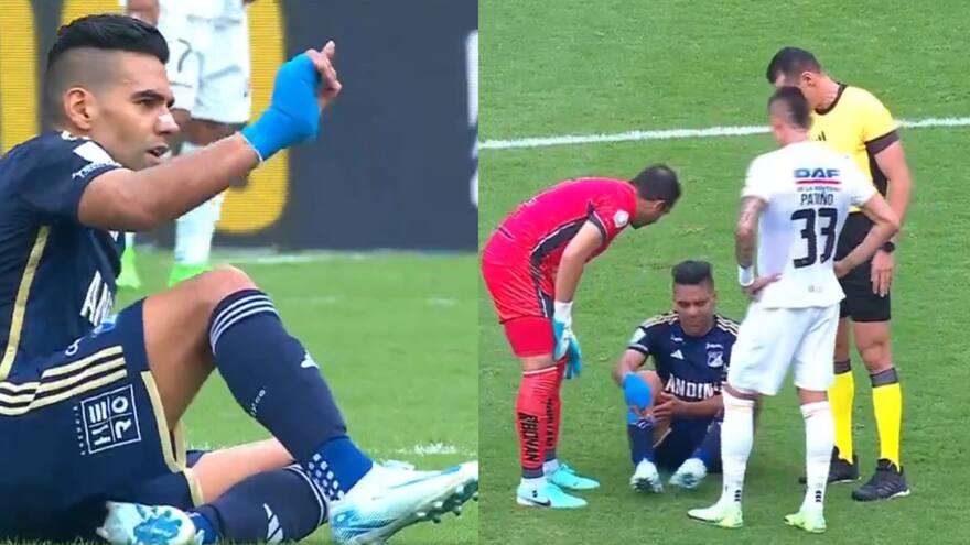 Radamel Falcao sufrió lesión en partido contra el Once Caldas