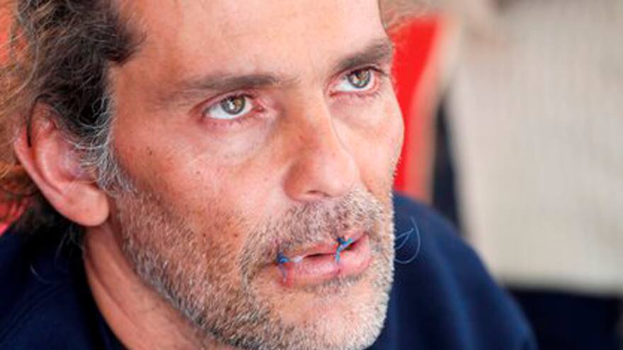 Escultor John Fitzgerald se cose los labios para reclamar atención a artistas