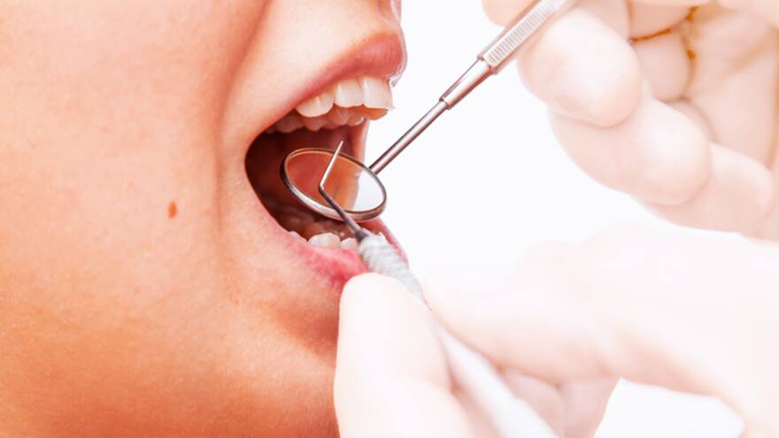 Alerta sobre enfermedades periodontales