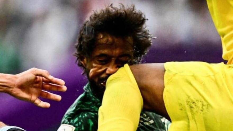 Alshahrani recibió un terrible golpe en el triunfo de Arabia sobre Argentina