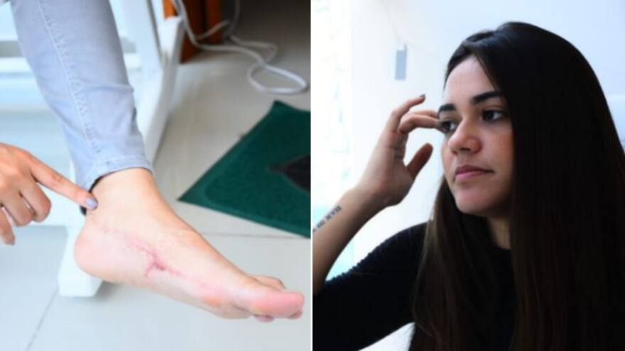 En video | Aparecen denuncias de más accidentes en playas de Cholón