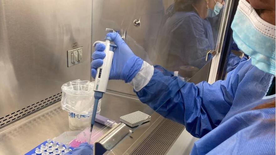 Descartan caso de viruela símica en el Cesar