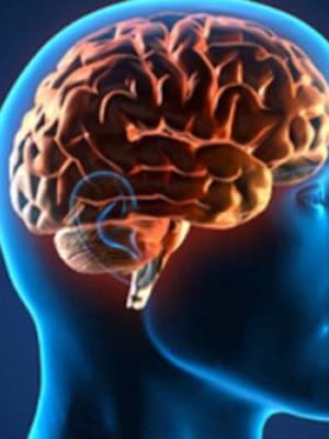 Neuronas de la vergüenza