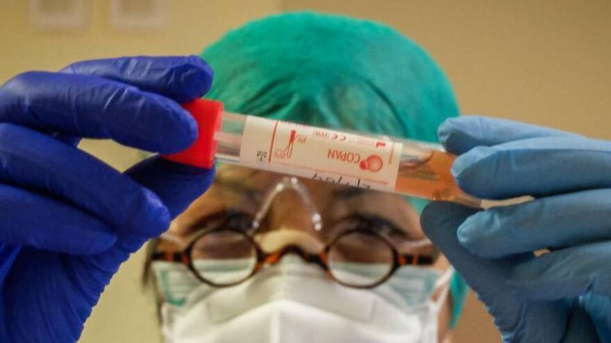 'Las reinfecciones son raras y leves o asintomáticas'