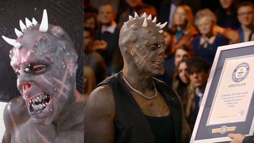 Así luce la persona con más implantes de cuernos en la cabeza en el mundo