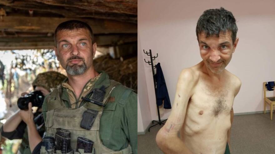 Así luce prisionero de guerra de Ucrania liberado recientemente