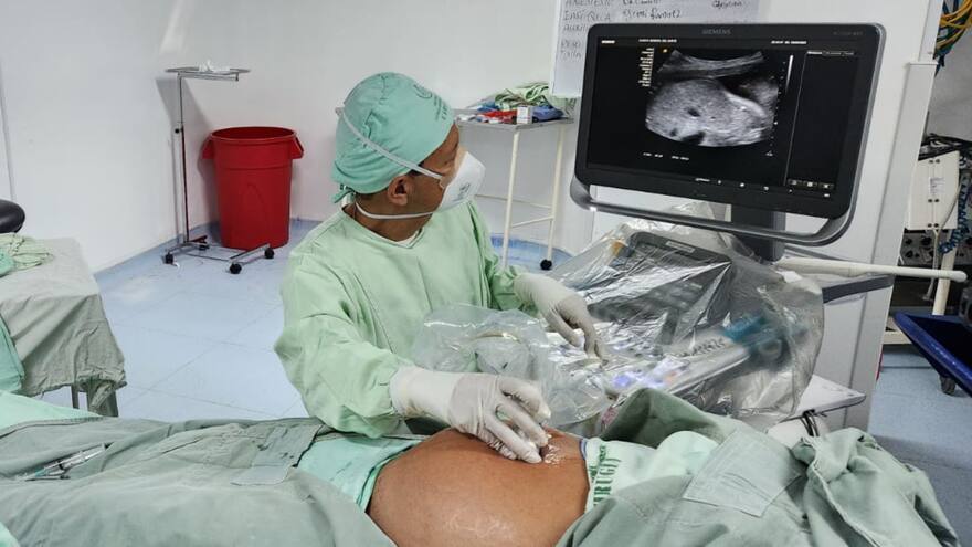 En B/quilla corrigen defecto congénito a bebé con novedosa técnica quirúrgica