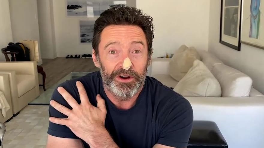 Hugh Jackman da negativo en dos biopsias ante el riesgo de cáncer de piel
