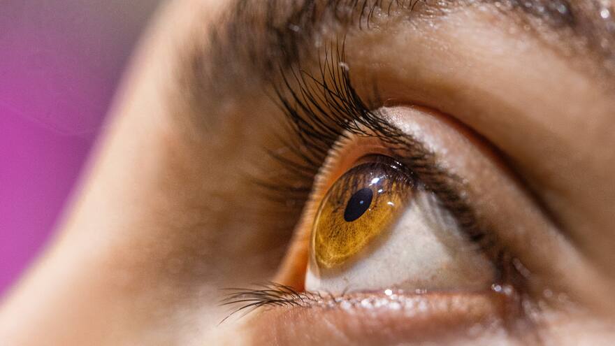 'Es frustrante': Zharick, la joven barranquillera que sangra por los ojos