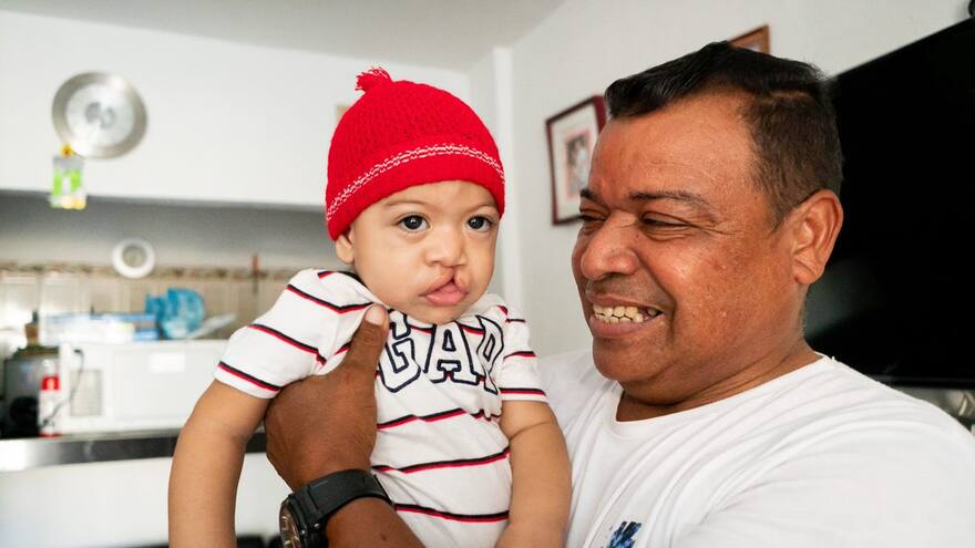 Anuncian cirugías gratis para menores con paladar hendido en Montería