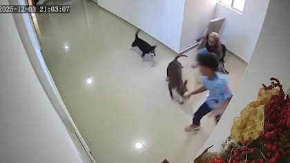 Menor de 10 años fue atacado por perro pitbull en conjunto residencial del norte de Barranquilla