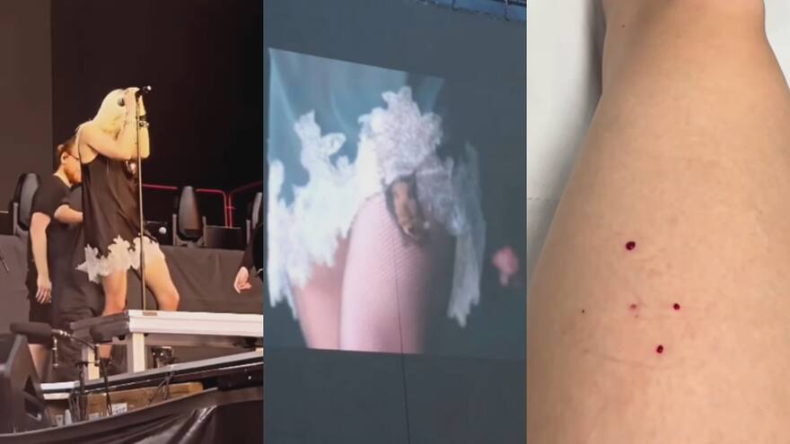 Murciélago mordió a la cantante Taylor Momsen en pleno concierto