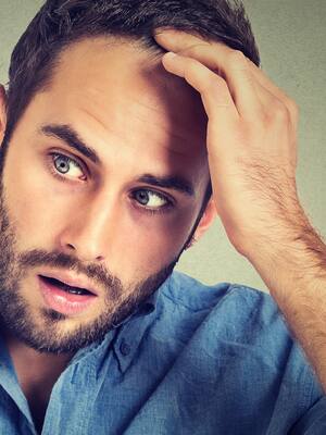 Efluvio telógeno | Columna de Haroldo Martínez