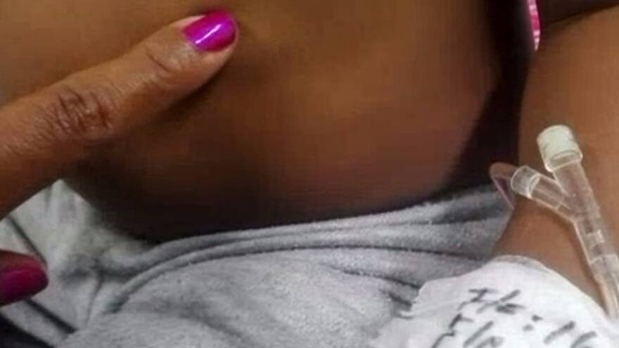 Niño de tres años dura siete días con una moneda dentro del cuerpo