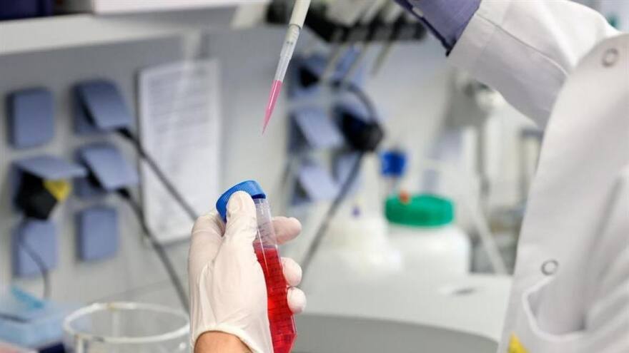 ¿Por qué disminuye la cantidad y calidad de espermatozoides en los hombres de todo el mundo?