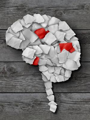 Glioblastoma multiforme