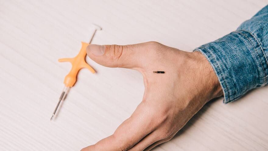 Implantes de microchip, la nueva apuesta de pago