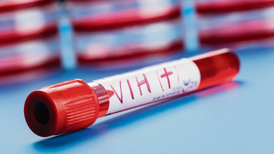 397 nuevos casos de VIH positivo se registran en 2013
