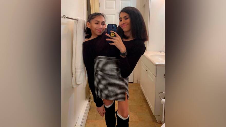 Así son Carmen y Lupita Andrade, las siamesas que comparten su vida en TikTok