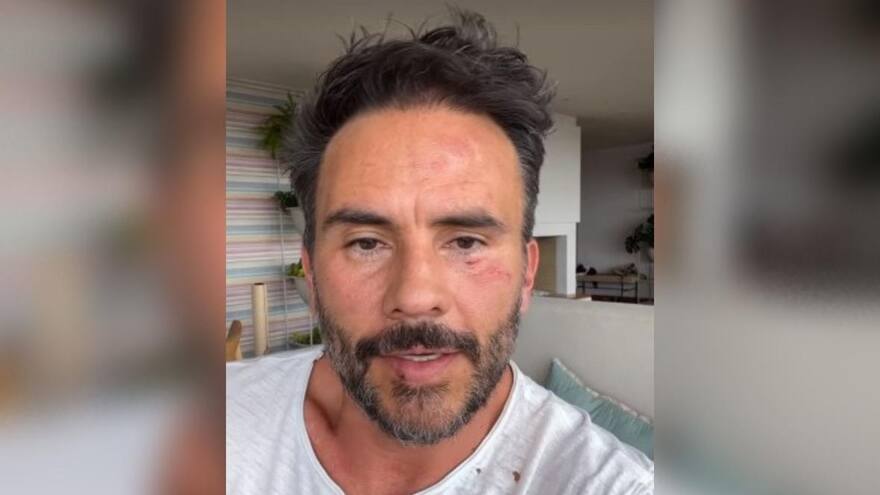 Atraco a Juan Pablo Raba: ofrecen recompensa por los responsables y revelan retrato hablado