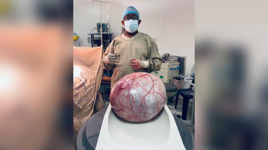 Extirpan un tumor de 12 kilogramos a una mujer en Uribia, La Guajira